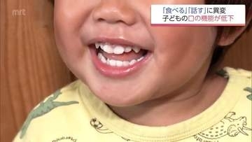 お口がぽかん  子どもの口腔機能発達不全症が全国で増加 昔ながらの遊び減少も原因に