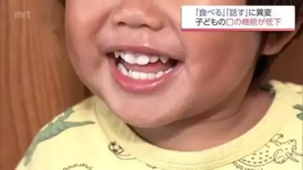 お口がぽかん  子どもの口腔機能発達不全症が全国で増加 昔ながらの遊び減少も原因に