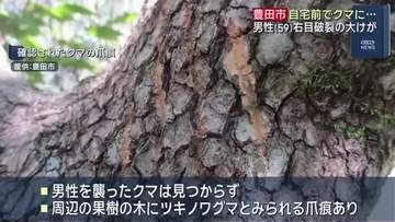 自宅前で59歳男性がクマに襲われる…右目の眼球破裂の大けが 愛知・豊田市