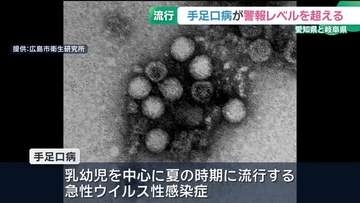 全国的に流行「手足口病」　愛知県と岐阜県で警報レベル超に　手洗いなど呼びかけ