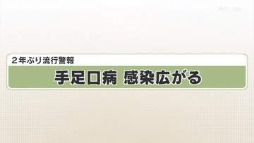 ２年ぶり流行警報　手足口病　感染広がる