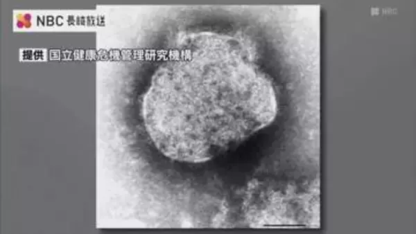 2026年2例目のはしか感染確認　発症前後の期間公共交通機関は利用せず　長崎市