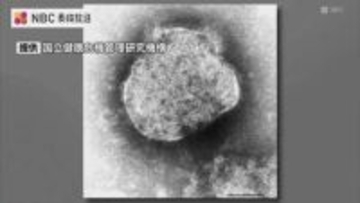 2026年2例目のはしか感染確認　発症前後の期間公共交通機関は利用せず　長崎市