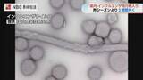 「インフルエンザ流行期入り 昨季より3週間早く新学期前に感染対策呼びかけ【長崎】」の画像1