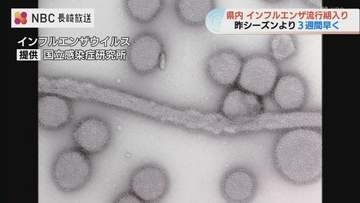 インフルエンザ流行期入り 昨季より3週間早く新学期前に感染対策呼びかけ【長崎】