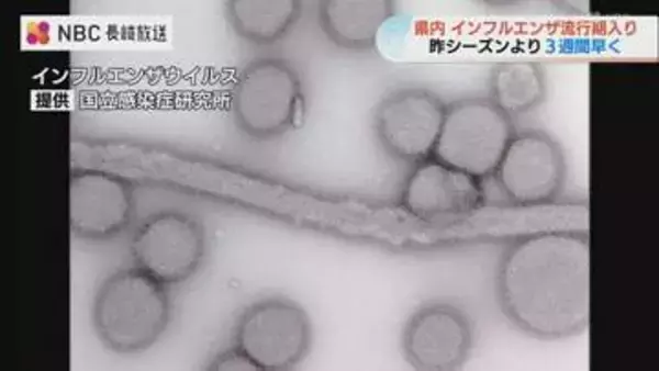 インフルエンザ流行期入り 昨季より3週間早く新学期前に感染対策呼びかけ【長崎】