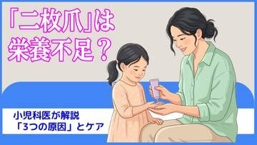 子どもの「二枚爪」は栄養不足？ 小児科医が解説「3つの原因」とケア