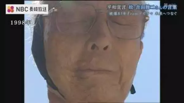 「平和の原点とは人間の痛みがわかる心」大やけどを負った被爆者・田勝二さんの記憶　長崎平和宣言に体験とメッセージ