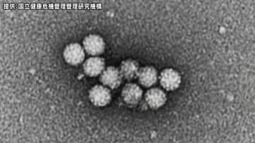 ウィンタースポーツの合宿で来た中学生18人に嘔吐、下痢などの症状　長野・野沢温泉村の旅館でノロウイルスによる食中毒が発生　患者と調理従事者の便からウイルスを検出