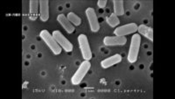 宿泊施設でバイキング形式の夕食を食べた18人が食中毒　原因は「ウエルシュ菌」宿泊施設は3日間営業停止に　長野・上田市
