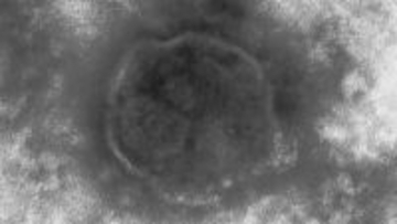 はしかに感染の女性が「特急しなの」塩尻駅ー名古屋駅を利用　全国の感染者数は去年同時期の10倍以上　“非常に感染力が強い”　長野県が注意呼びかけ