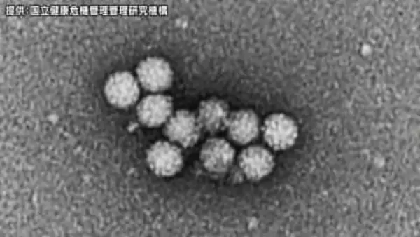 弁当、仕出し料理を食べ…10歳未満の子ども含む26人が下痢、腹痛など症状　ノロウイルスによる食中毒と断定