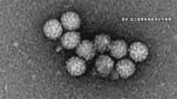 患者が急増…全県に「ノロウイルス食中毒注意報」　長野県