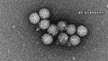 ノロウイルスで14人が感染 長野県佐久市の飲食店 県は改めて感染予防策呼びかけ