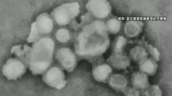 インフルエンザ2週連続で減少も…依然、多い状態続く　年末年始は人の移動や接触の機会が増える時期　長野県が感染予防呼びかけ