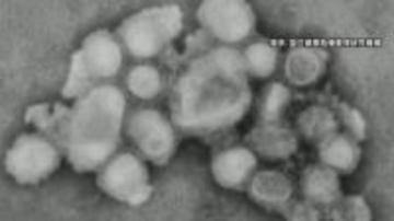 インフルエンザ2週連続で減少も…依然、多い状態続く　年末年始は人の移動や接触の機会が増える時期　長野県が感染予防呼びかけ