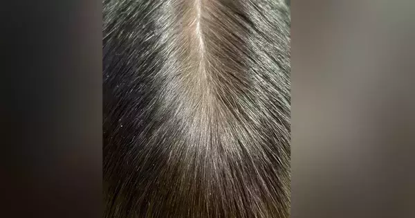 『人間の頭頂部』かと思いきや……信じられない『まさかの正体』に３万いいね「いや頭頂部でしょｗ」「とんでもない花火に見えた」