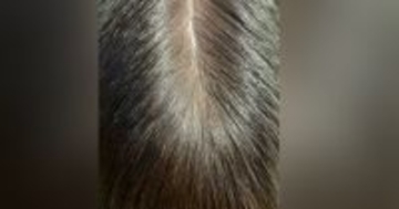 『人間の頭頂部』かと思いきや……信じられない『まさかの正体』に３万いいね「いや頭頂部でしょｗ」「とんでもない花火に見えた」