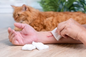 人間の命に関わる『猫ひっかき病』とは？油断できない理由や傷を負ったときの適切な対処法