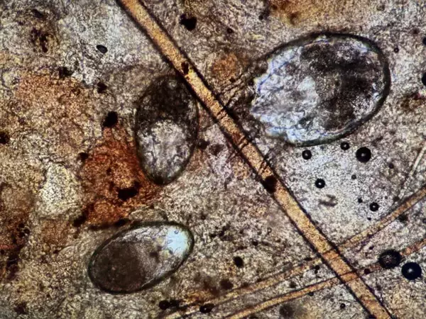 猫に寄生する『耳ダニ』が引き起こす5つの症状　発症のサインや感染対策まで解説