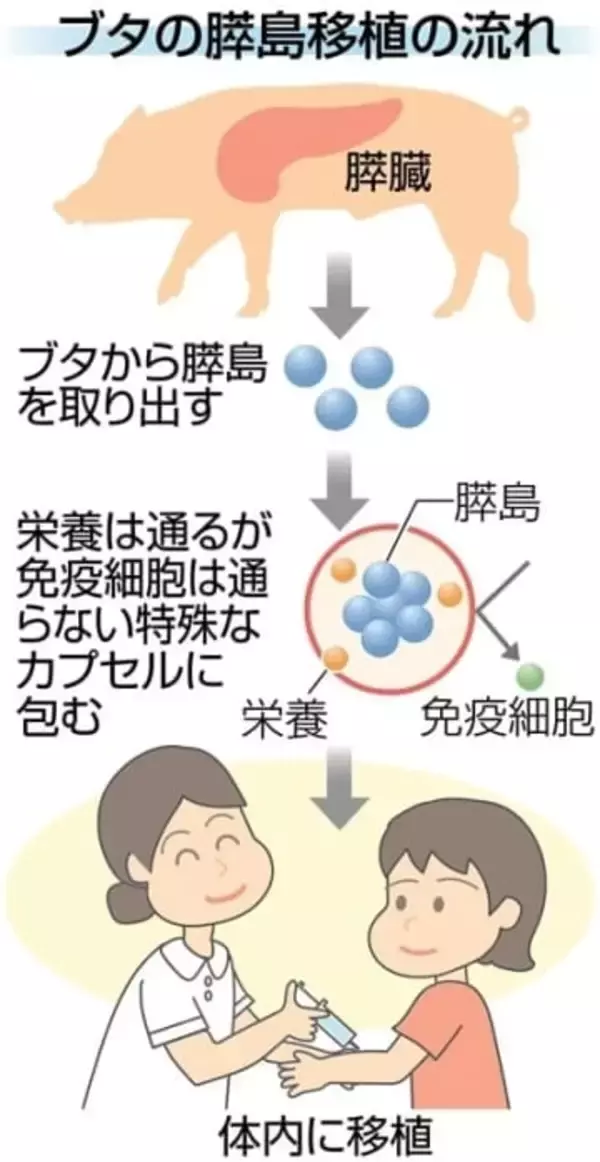 【独自】福岡大が糖尿病患者へ「ブタ膵臓細胞移植」　新たな治療法、年内にも実証実験着手