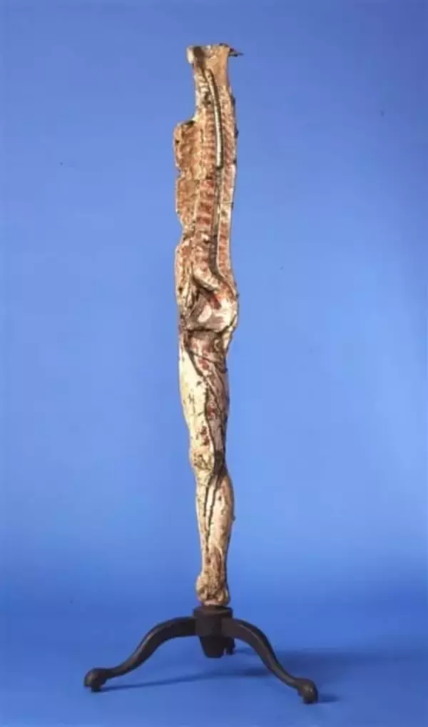 ［長崎県］「キュンストレーキ」残したい　長崎大　被爆の記憶伝える人体模型　進む経年劣化　修復、保存へエックス線検査