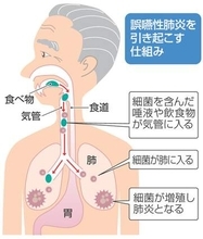 災害時の避難生活で命を守るには　九州大教授がエコノミークラス症候群や熱中症対策を解説