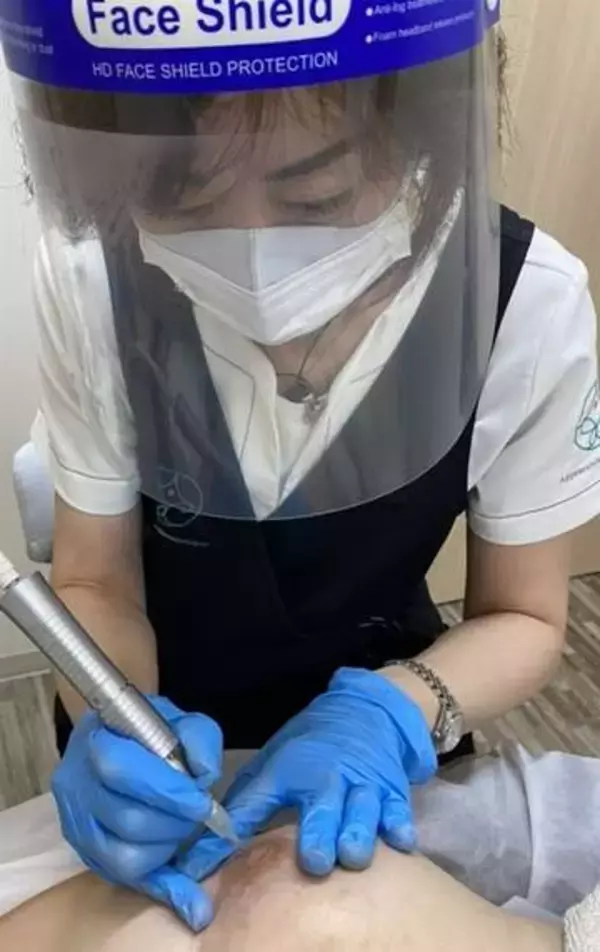 乳がんで失った胸、産後の抜け毛…　医療「アートメーク」注目　「見た目」の悩みに寄り添う