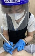 乳がんで失った胸、産後の抜け毛…　医療「アートメーク」注目　「見た目」の悩みに寄り添う