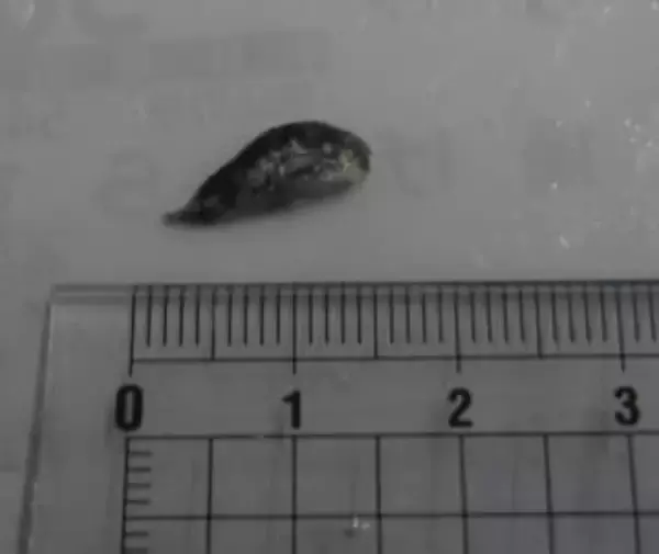 「釜揚げしらす」にフグの稚魚混入　福岡市西区のスーパー、店が自主回収