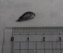 「釜揚げしらす」にフグの稚魚混入　福岡市西区のスーパー、店が自主回収