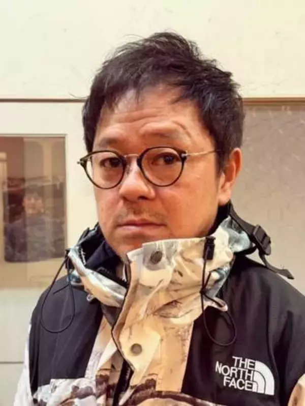 「これは酷い！」「顔全体が…」〝白髪染め〟アレルギーで〝顔ボコボコ〟56歳人気芸人の報告にSNS騒然「お仕事に支障が出そう」
