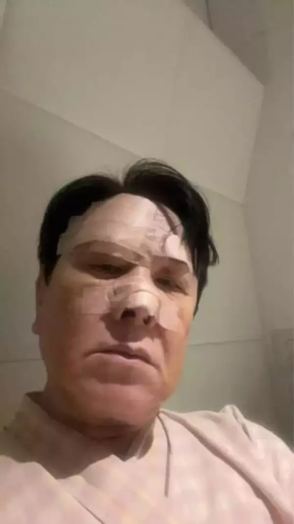 「でっかい傷跡にショック」顔面大ケガから1カ月…71歳三ツ矢雄二、経過報告ショットに反響「え、大丈夫!?」「そんな大怪我でビックリ」