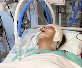 「頭を壁に打ち付けられた様な衝撃…」俳優が脳出血で顔面崩壊、後遺症も…術後7年、間瀬翔太〝40歳の今〟に「励まされる」「頑張って！」エール続々