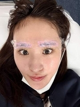 「眉アート失敗された…」〝衝撃〟の施術後ショットをYouTuberめしあが公開「これは酷い…」「一生これ？だったらキツイ」の声