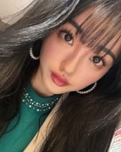 「あとが残らないことを…」手の甲がどす黒く…人気新喜劇女優の小寺真理〝痛々しい〟写真に「結構ひどい」「痛そう」の声