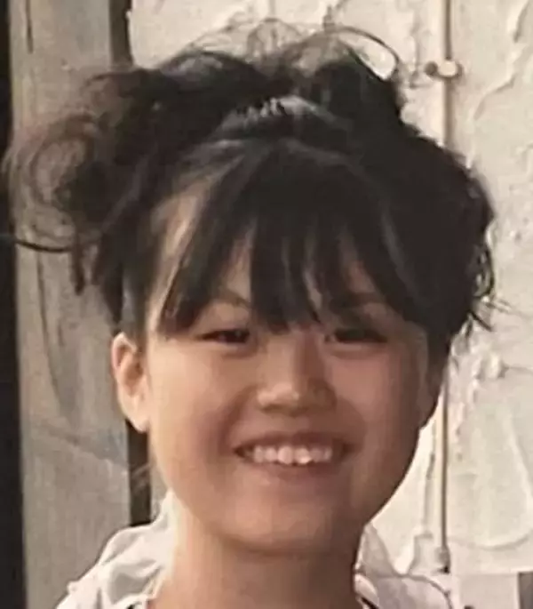 「整形は老化早い」意見に反論！〝整形総額1350万円〟32歳YouTuber、整形後の7年前⇒現在〝比較写真〟公開「むしろ進化してるじゃん！」「可愛さがアップデート」反響続々