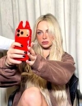 頭部激突⇒巨大たんこぶ！WWEリヴ・モーガン〝衝撃〟襲撃動画＆傷痕写真に「これはほぼ事故」「いやあ、これはハードラックだ…」の声