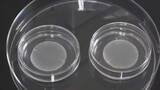 「重症の心不全患者向けのiPS製品に保険適用　薬価5320万円」の画像1