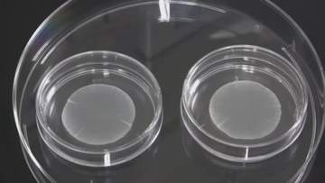 重症の心不全患者向けのiPS製品に保険適用　薬価5320万円