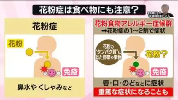 花粉症は食べ物にも注意？　「花粉食物アレルギー」とは――唇の腫れやのどのイガイガ…重篤な症状も【なるほどッ！】