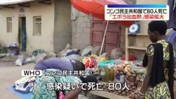 コンゴ民主共和国で「公衆衛生上の緊急事態」エボラ出血熱疑いで80人死亡