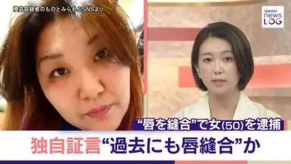 【独自証言】「自ら唇を縫っていた」同居女性傷害事件、知人が明かす異様な光景 50歳女は関与否定【news LOG】
