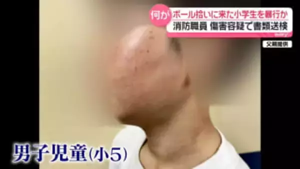 消防職員、ボール拾いに来た小学生に暴行・ケガさせたか　書類送検