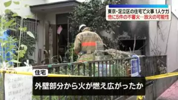 東京・足立区の住宅で火事　1人ケガ　付近で5件の不審火…放火の可能性