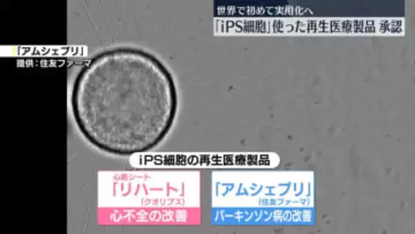 iPS細胞使った再生医療製品を正式承認　世界で初めて実用化へ