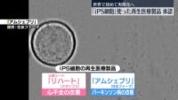 iPS細胞使った再生医療製品を正式承認　世界で初めて実用化へ