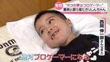 「ゲームの中で闘っているのは寝たきりの少年――難病を抱えた少年とeスポーツの世界　“ゲームの中は自分らしくいられる場所”『every.特集』」の画像1