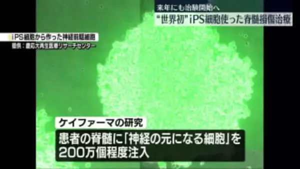 慶大発ベンチャー “iPS細胞で脊髄損傷治療”来年末にも治験へ