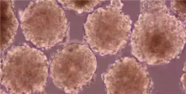 iPS細胞から作った心筋細胞を心臓に注入する治験　患者10人の経過を発表